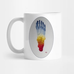 Raynaud's Disease Mug